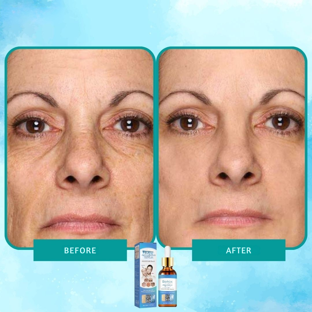 Serum botox elixir anti-rynker intens 